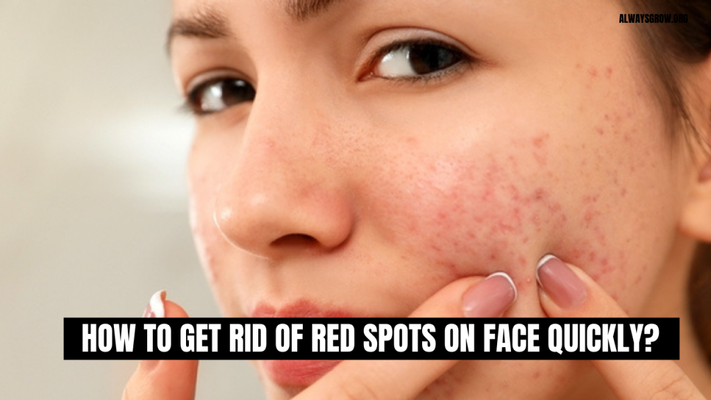 how-to-get-rid-of-red-spots-on-face-overnight-soulhealthlife