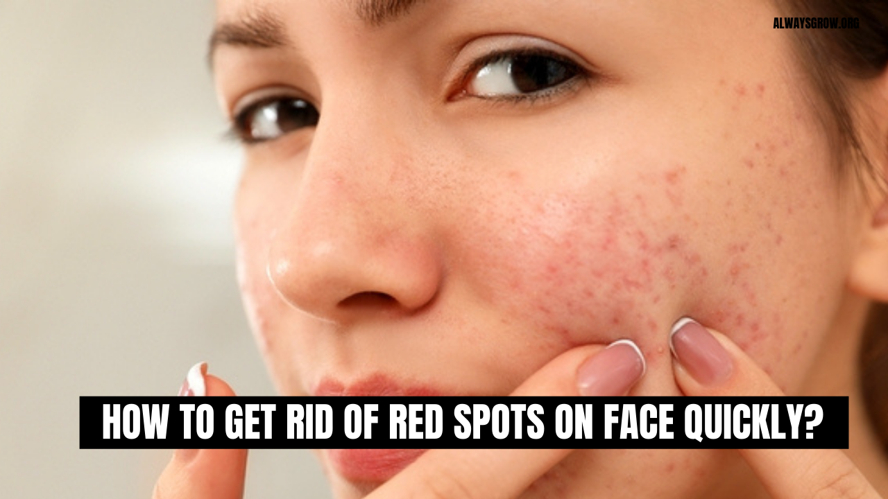 How To Get Rid Of Red Spots On Face Quickly? ( 9 Tips)