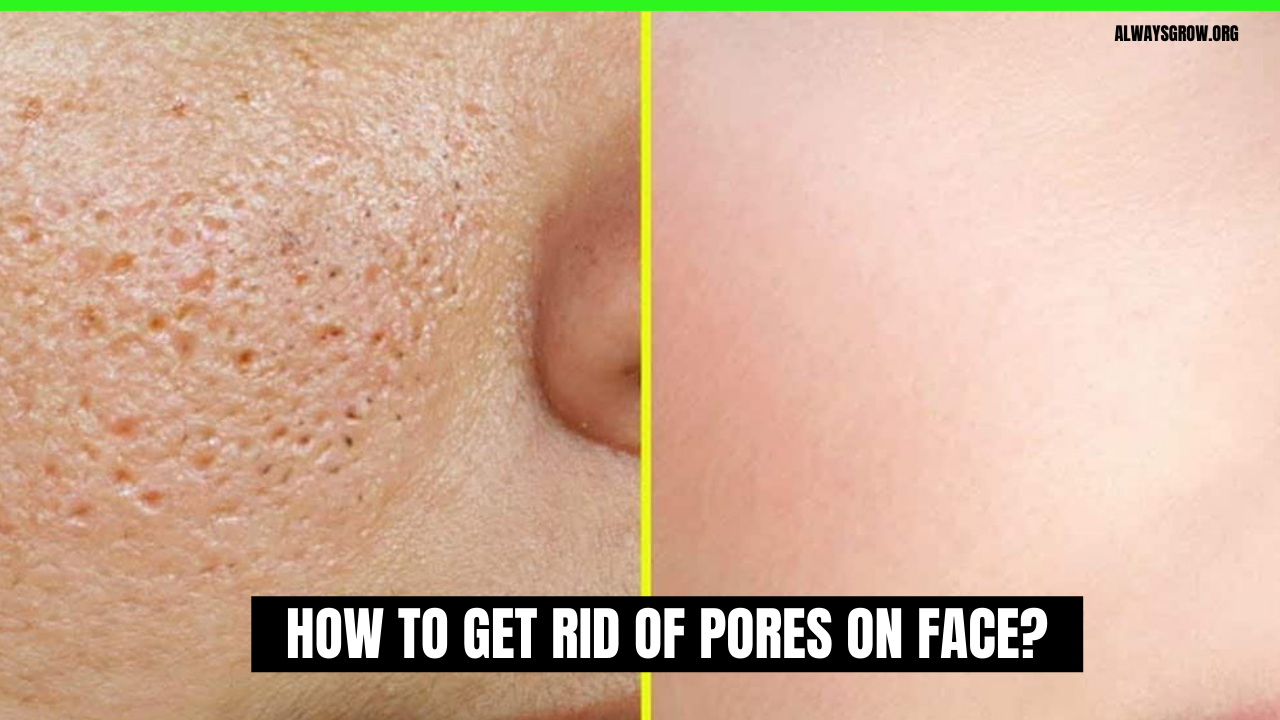 How To Get Rid Of Pores On Face? (8 Secrets)